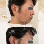 ⛳️夫のシミとりました〜